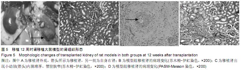 改进SD-Wistar大鼠肾移植慢性排斥模型的造模方法