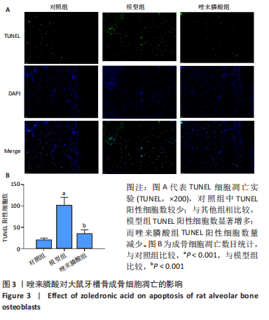 Túnel  雜誌