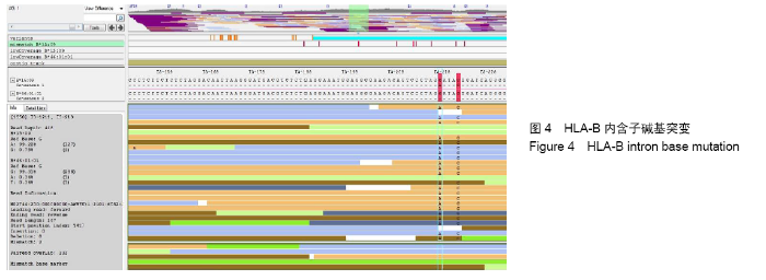 Characterization of the novel HLA‐B*46:41N allele - Zheng - 2020